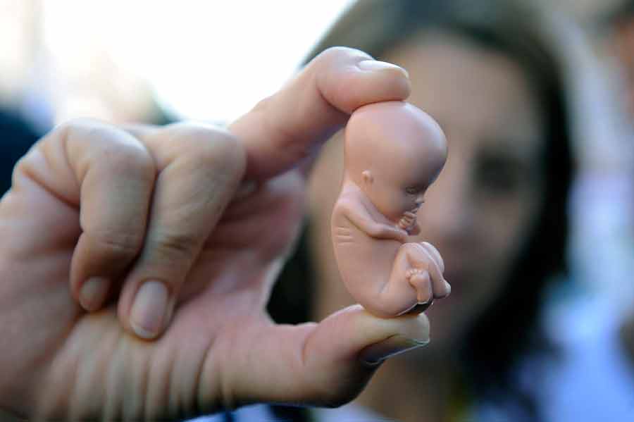 Аборт на ранних сроках беременности